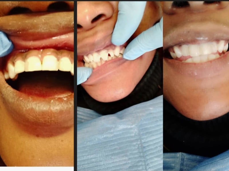 Missions tríps seventh day adventist